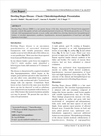 Case Report  Dowling Degos Disease : Classic Clinicohistopathologic Presentation  Jayesh I. Mukhi*,