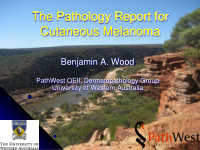 the pathology report for cutaneous melanoma