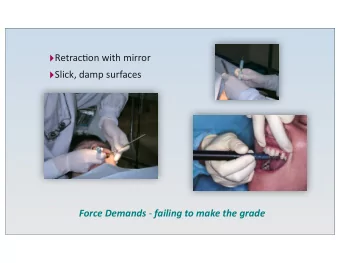 Contemporary polishing considerations  Many  pa(ents  expect  polishing  Coarse
