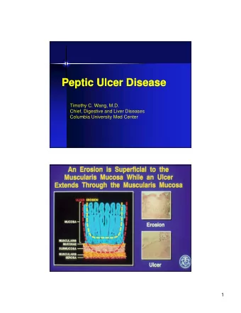 Peptic Ulcer Disease  Peptic Ulcer Disease  Timothy C. Wang, M.D.  Chief, Digestive and Liver