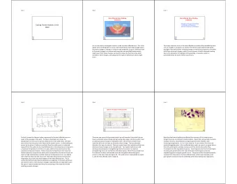 Cooling Transformations in the  in Changes in Properties  Cold Cracking Due to Hydrogen  Weld