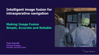 Intelligent image fusion for  intraoperative navigation  Making Image Fusion  Simple, Accurate and