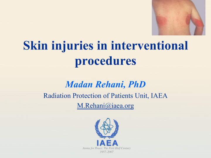 skin injuries in interventional procedures