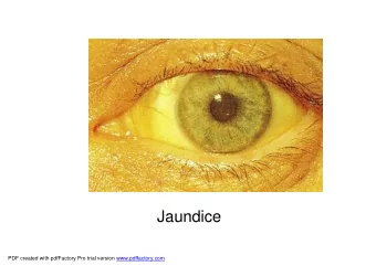 Jaundice  PDF created with pdfFactory Pro trial version www.pdffactory.com  Butter fly rash  SLE