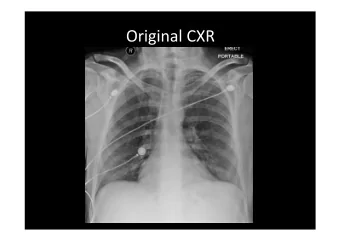 Transfused 2 Units  Enoxaparin 90mg  Devon, Karen M., and Robin S. McLeod. &quot;Pre and