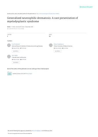 Generalized neutrophilic dermatosis: A rare presentation of  myelodysplastic syndrome Article in