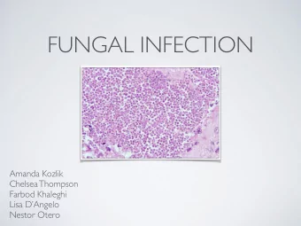 FUNGAL INFECTION  Amanda Kozlik  Chelsea Thompson  Farbod Khaleghi  Lisa DAngelo  Nestor Otero