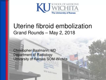 Uterine fibroid embolization  Grand Rounds  May 2, 2018  Christopher Baalmann, MD  Department of
