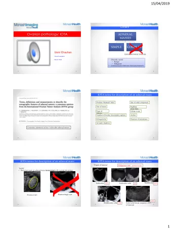 X  Multilocular  Unilocular  0.3%  Unilocular solid  2%  16%  Haemorrhagic cyst  Struma ovarii  40%