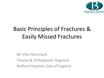 Basic Principles of Fractures &amp;  Easily Missed Fractures  Mr Irfan Merchant  Trauma &amp;