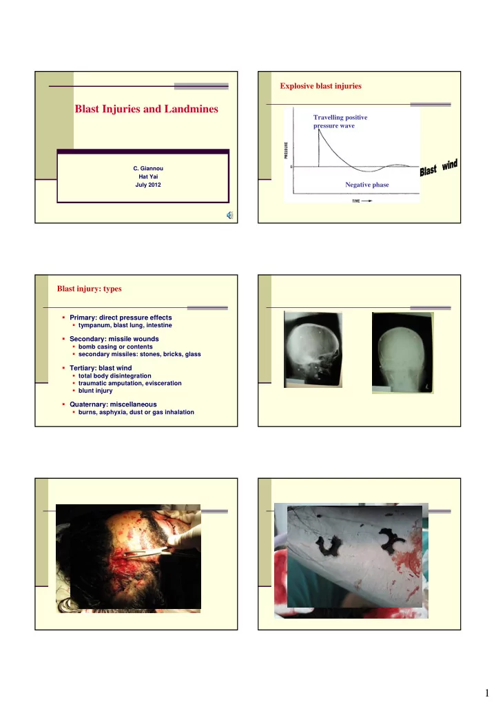 blast injuries and landmines