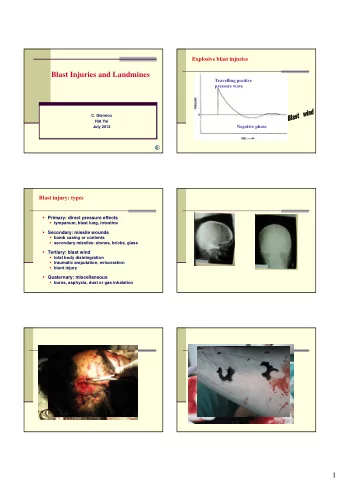 Blast Injuries and Landmines  Travelling positive  pressure wave  C. Giannou  Hat Yai  July 2012