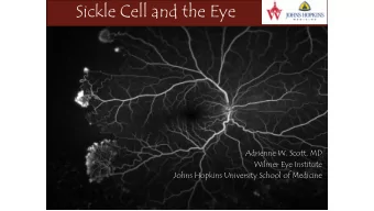 Sickle Cell and the Eye  Adrienne W. Scott, MD  Wilmer Eye Institute  Johns Hopkins University
