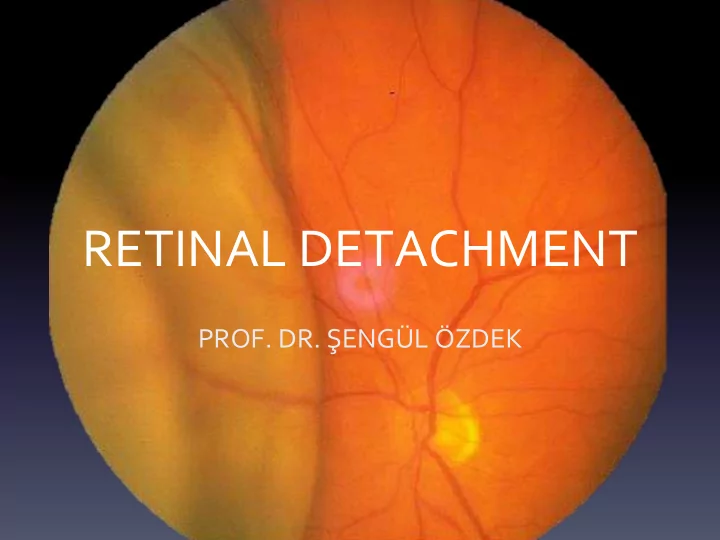 retinal detachment
