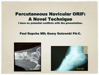 Percutan  Percutaneous  eous Navicular  Navicular ORIF:  ORIF:  A  A Novel Technique  Novel