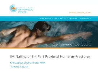 IM Nailing of 3-4 Part Proximal Humerus Fractures  Christopher Chuinard MD, MPH  Traverse City, MI