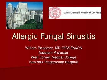 Allergic Fungal Sinusitis  Allergic Fungal Sinusitis  William Reisacher, MD FACS FAAOA  William