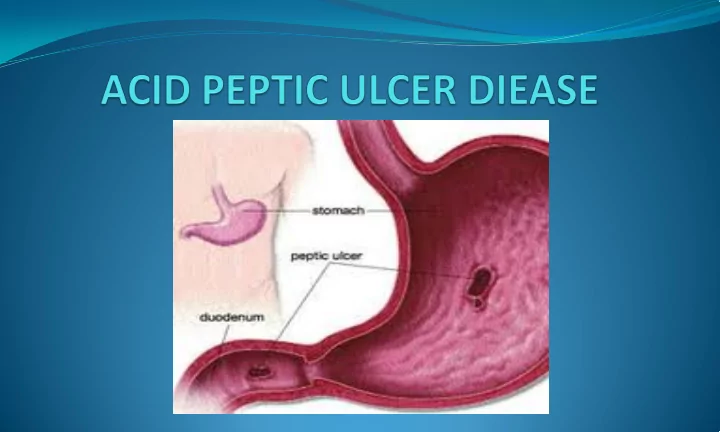 an eroded lesion in either the esophageal gastric or