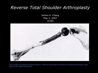 Reverse Total Shoulder Arthroplasty  James H. Chang  -- First shoulder arthroplasty  May 3, 2007