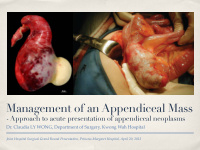 management of an appendiceal mass
