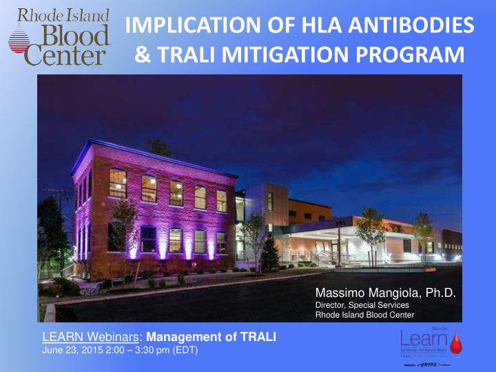 implication of hla antibodies amp trali mitigation program
