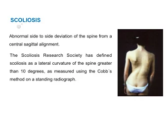 SCOLIOSIS  Abnormal side to side deviation of the spine from a  central sagittal alignment.  The