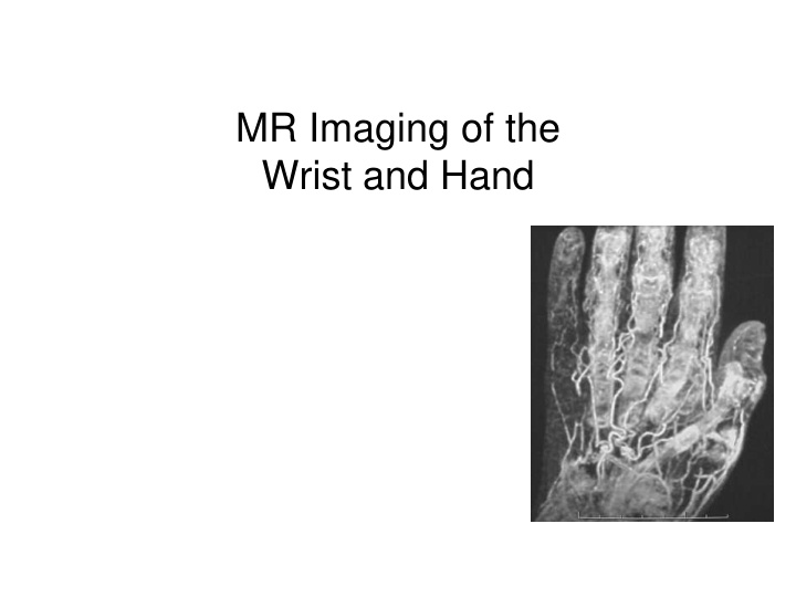 mr imaging of the wrist and hand mr wrist and hand