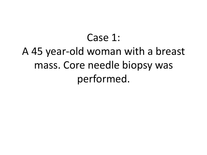 a 45 year old woman with a breast mass core needle biopsy