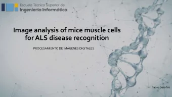 for ALS disease recognition  PROCESAMIENTO DE IMGENES DIGITALES  Paolo Serafini  Introduction