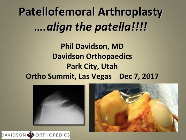 patellofemoral arthroplasty align the patella