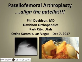 Patellofemoral Arthroplasty  .align the patella!!!!  Phil Davidson, MD  Davidson Orthopaedics