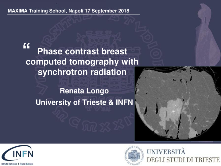 phase contrast breast computed tomography with