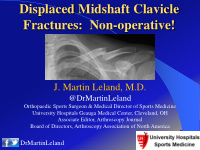 displaced midshaft clavicle fractures non operative