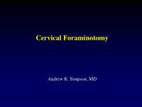 cervical foraminotomy