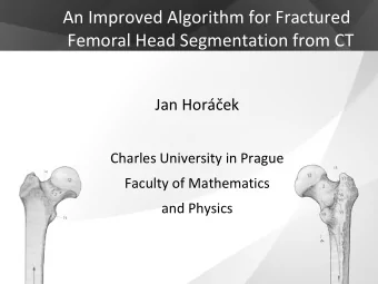 An Improved Algorithm for Fractured  Femoral Head Segmentation from CT  Jan Horek  Charles
