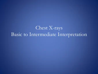 Chest X-rays  Basic to Intermediate Interpretation  Relative Densities  The images seen on a chest