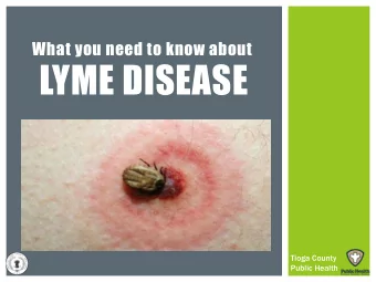 LYME DISEASE  Tioga County  Public Health  MOST COMMON TICKS IN NEW YORK STATE  The American Dog