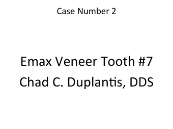 Emax  Veneer  Tooth  #7    Chad  C.  Duplan;s,  DDS
