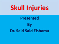 skull injuries