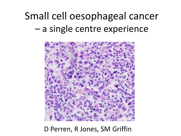 small cell oesophageal cancer