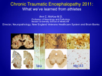 chronic traumatic encephalopathy 2011