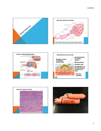 11/3/13    SKELETAL MUSCLE ANATOMY  B  A  L  E  U  S  S  I  T  E  L  C  S  U  M  MUSCLE FIBER