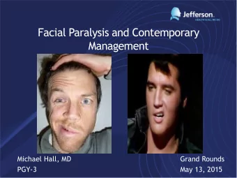 Facial Paralysis and Contemporary  Management  Michael Hall, MD  Grand Rounds  PGY-3  May 13, 2015