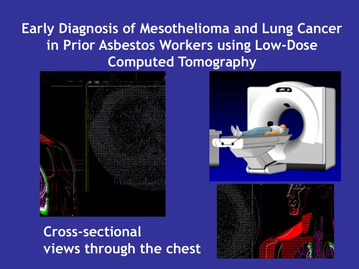 in prior asbestos workers using low dose