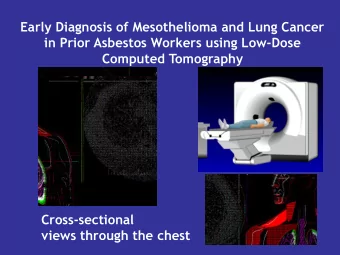 in Prior Asbestos Workers using Low-Dose  Computed Tomography  Cross-sectional  views through the