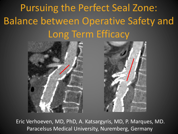 pursuing the perfect seal zone