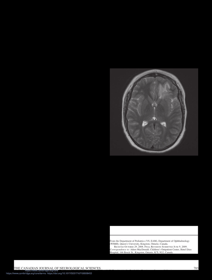 an unusual presentation of neurosarcoidosis in an 11 year