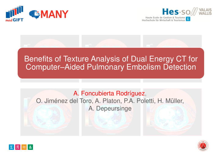 computer aided pulmonary embolism detection