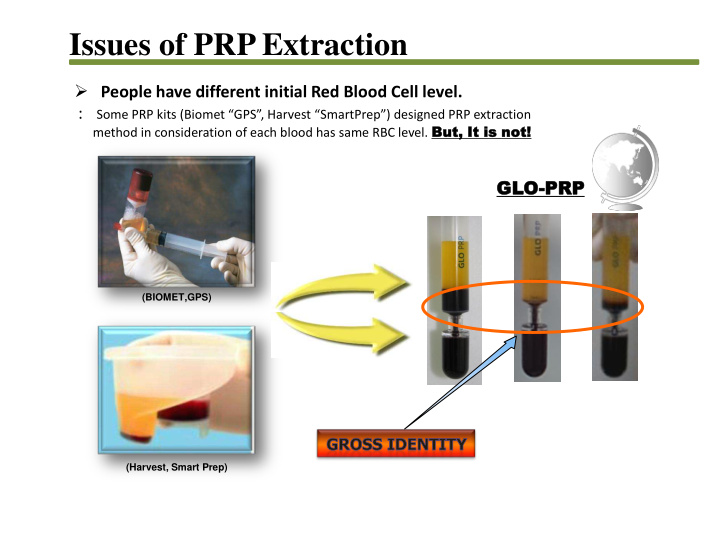 issues of prp extraction