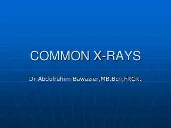 COMMON X-RAYS Dr.Abdulrahim Bawazier,MB.Bch,FRCR .